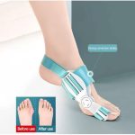 FEETIFIX - Correcteur pour les orteils en Valgus